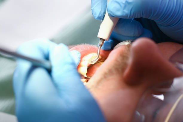 Best Emergency Treatment for Toothache in Lenwood, CA