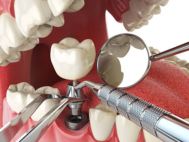 Best Emergency Broken Tooth Repair in Lenwood, CA